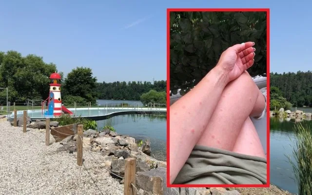 Jezírko Škodaland je po vyčištění bez vodních parazitů, kvalita vody je nyní dobrá a vhodná ke koupání