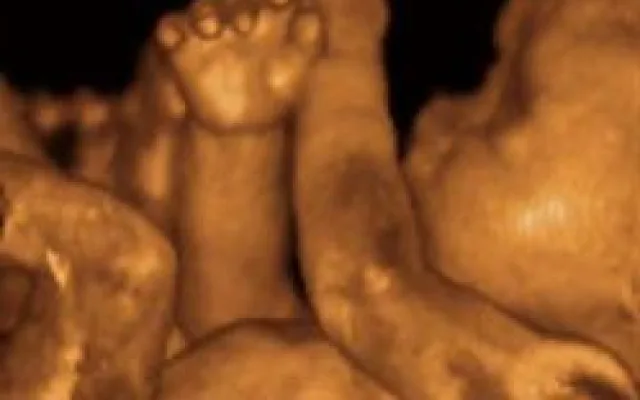 Nemocnice má novou 3D/4D sondu pro prostorové zobrazení plodu při ultrazvukovém vyšetření