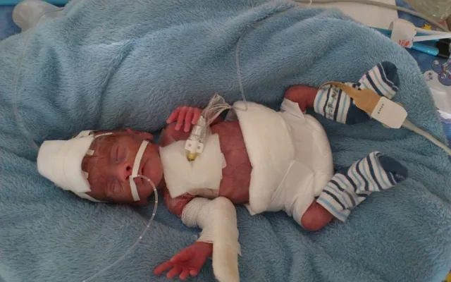 Když se narodili, vážili dohromady necelých 1200 gramů. Do života to Matějovi a Šimonovi přineslo řadu zdravotních problémů