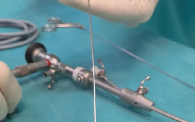 Gynekologické oddělení Domažlické nemocnice nově ambulantně provádí hysteroskopii