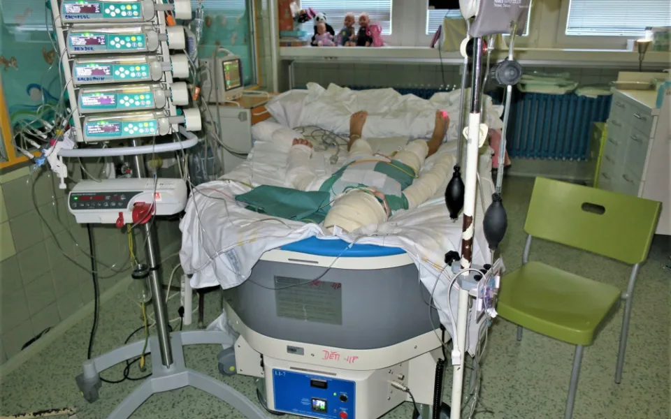 Lékaři v nemocnici řadu dní bojovali o život popálené Natálky