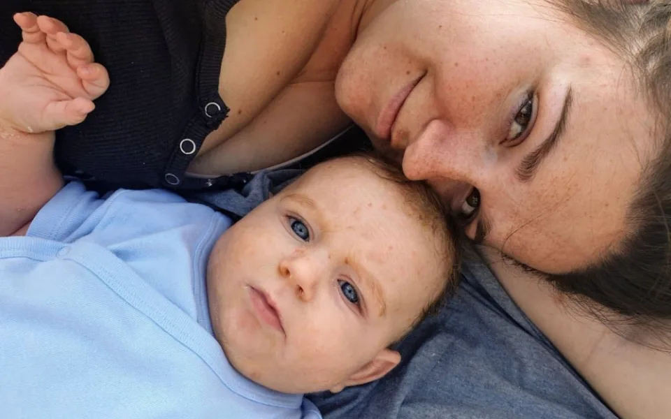 Roční Mareček bojuje se vzácným onemocněním kůže, na které neexistuje lék. Hrozí mu i přehřátí organismu