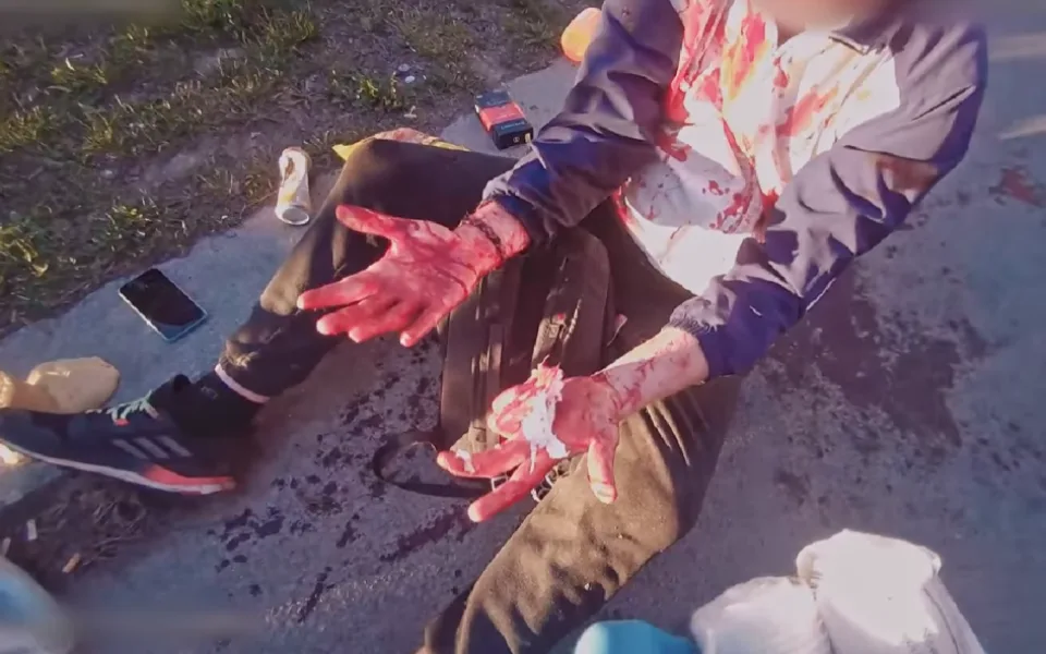 VIDEO: Ošklivým krvácivým zraněním skončil pro muže adrenalinový návrat z nákupu, když upadl na svoji tašku